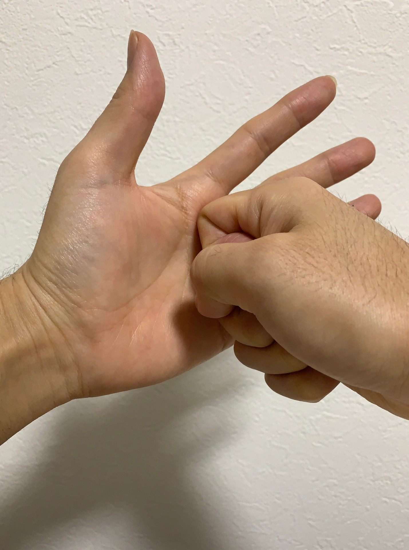 指 テーピング ばね 中指がばね指になったときのテーピングの巻き方などについて